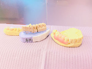 台南膺復假牙診所推薦，固定式假牙、活動式假牙、全口重建